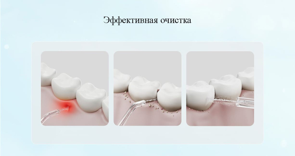 12 Ирригатор Xiaomi Mijia Electric Teeth Flosser F300.jpg