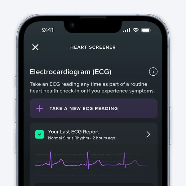 13 Фитнес-браслет WHOOP Life (MG).jpg